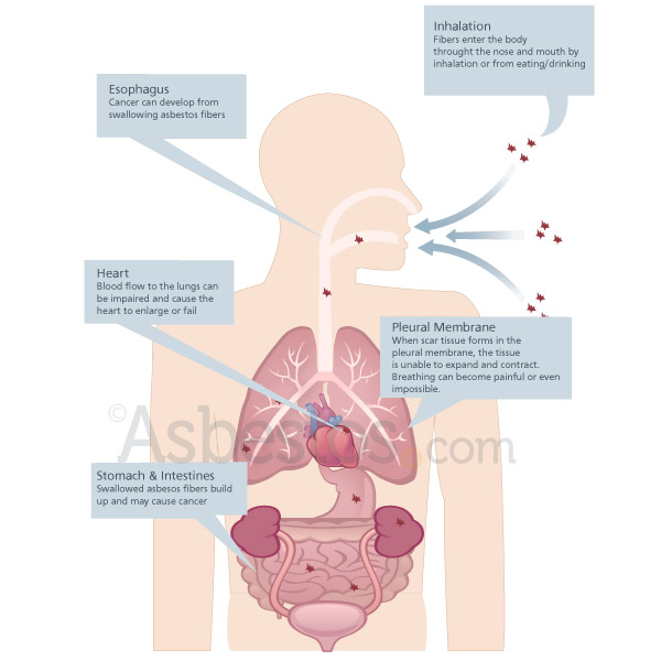 Asbestos Disposal & Removal Services Melbourne